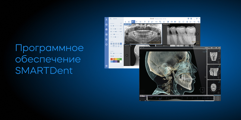 RAY Quantum 10×10 с цефалостатом, SMART DENT Frame 16.jpg