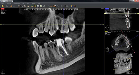 Owandy I-Max Touch 3D Ceph – Конусно-лучевой томограф 9х8